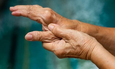 Alimentación para la artrosis: cómo retrasarla con la dieta