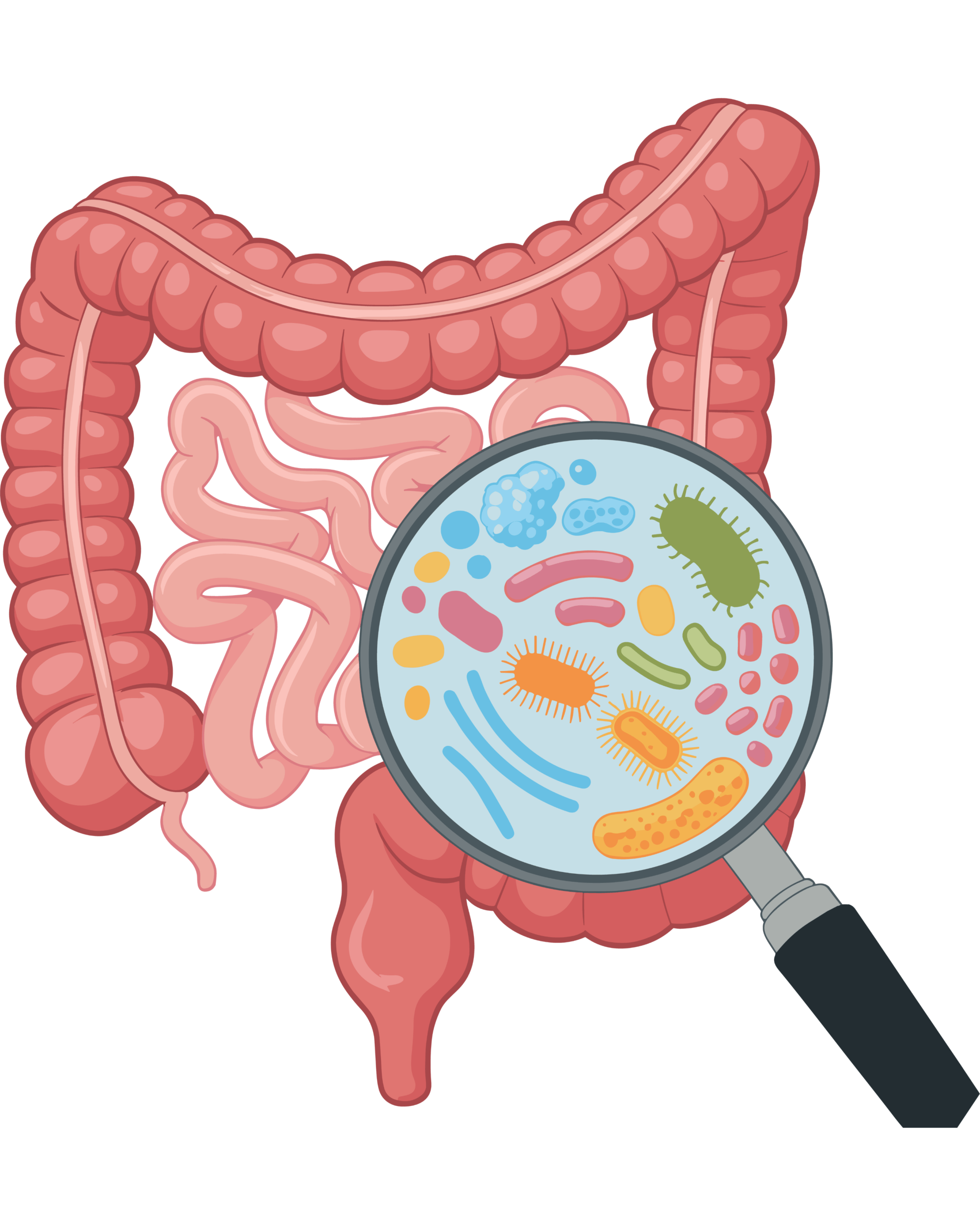 Nutrición clínica y digestivo 1 Tratamiento nutricional sobrecrecimiento bacteriano SIBO valencia